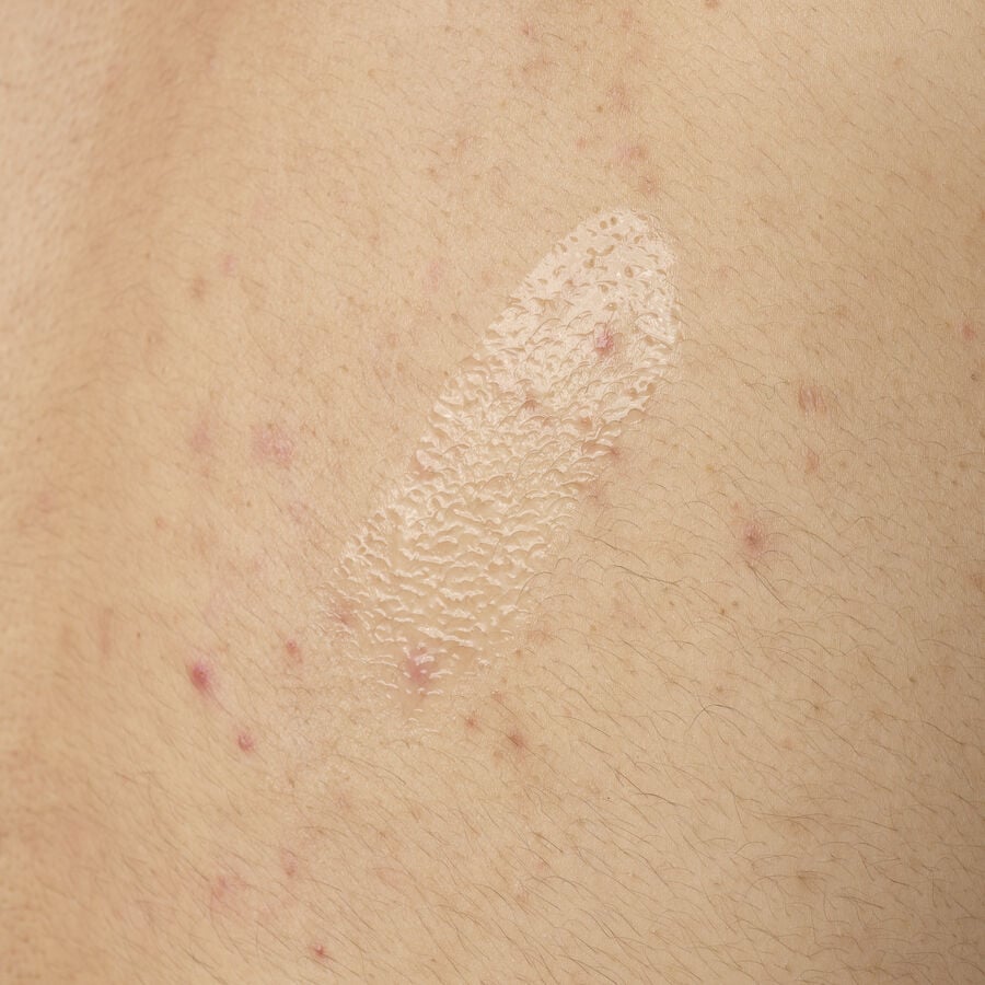 Salicylic Acid 0.5% Body Serum - US 9877
