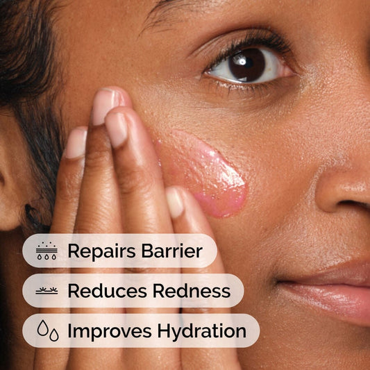 Soothing & Barrier Support Serum - US 9351