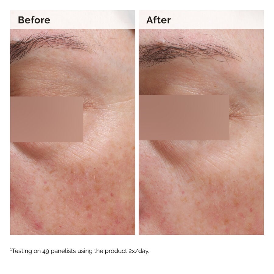 Niacinamide 5% Face and Body Emulsion - US 7817
