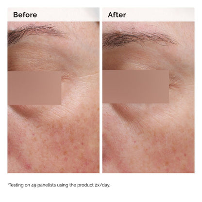 Niacinamide 5% Face and Body Emulsion - US 7817