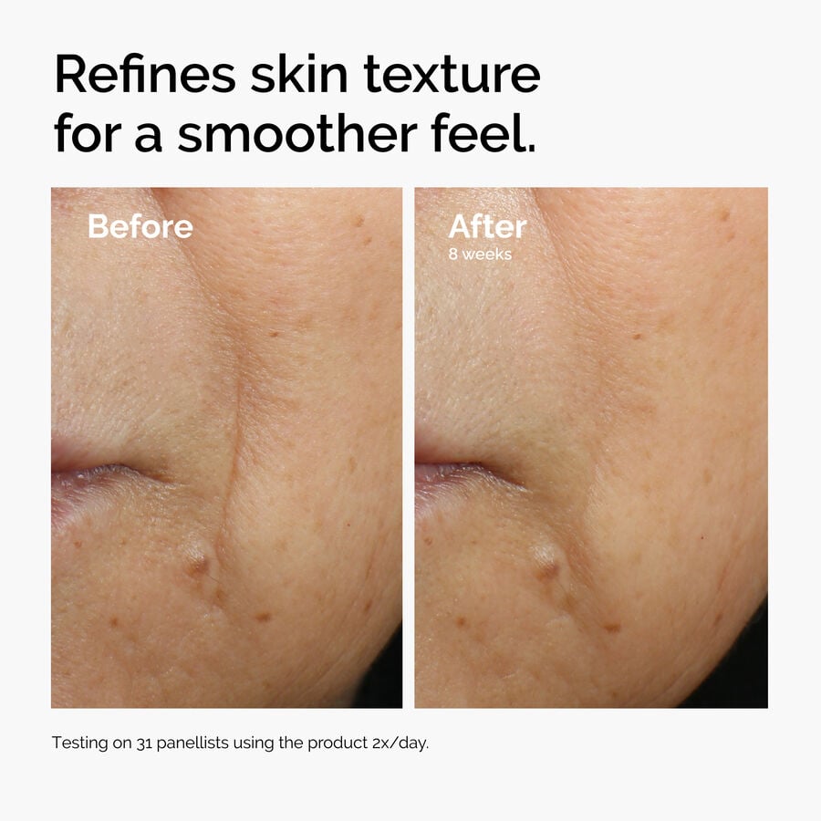 Caffeine 3% + Escin 1% Face Serum - US 9870