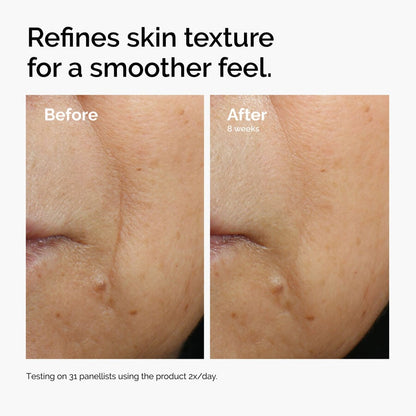 Caffeine 3% + Escin 1% Face Serum - US 9870