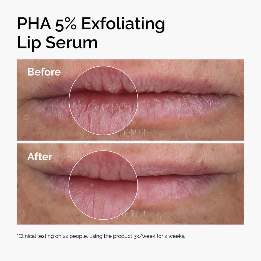 PHA 5% Exfoliating Lip Serum - US 9692