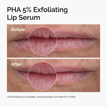 PHA 5% Exfoliating Lip Serum - US 9692